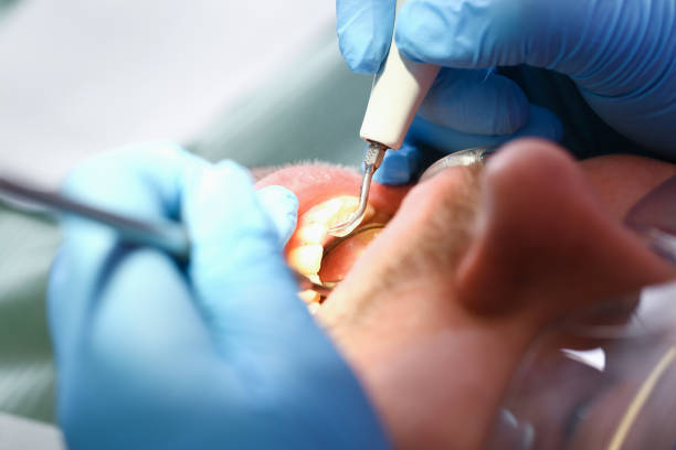Best Emergency Treatment for Dental Infections or Abscesses in Woodville, TX