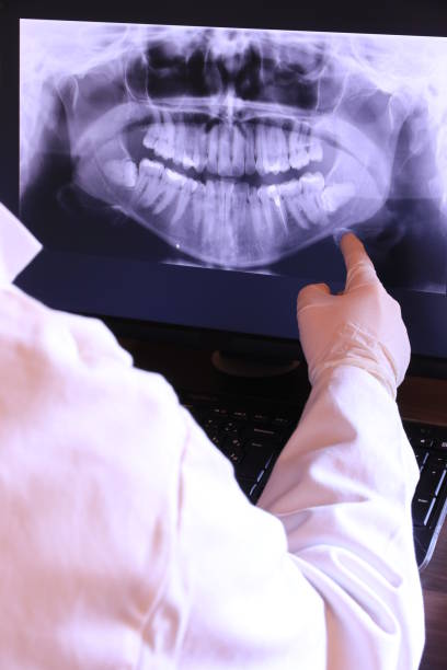 Best Emergency Tooth Extraction in Woodville, TX