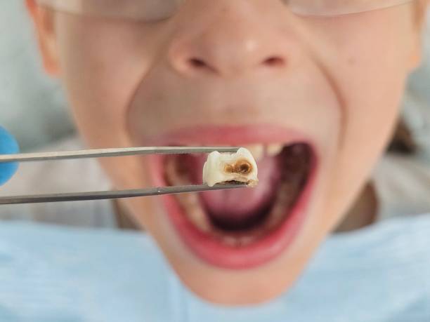 Best Pediatric Emergency Dentist in Woodville, TX